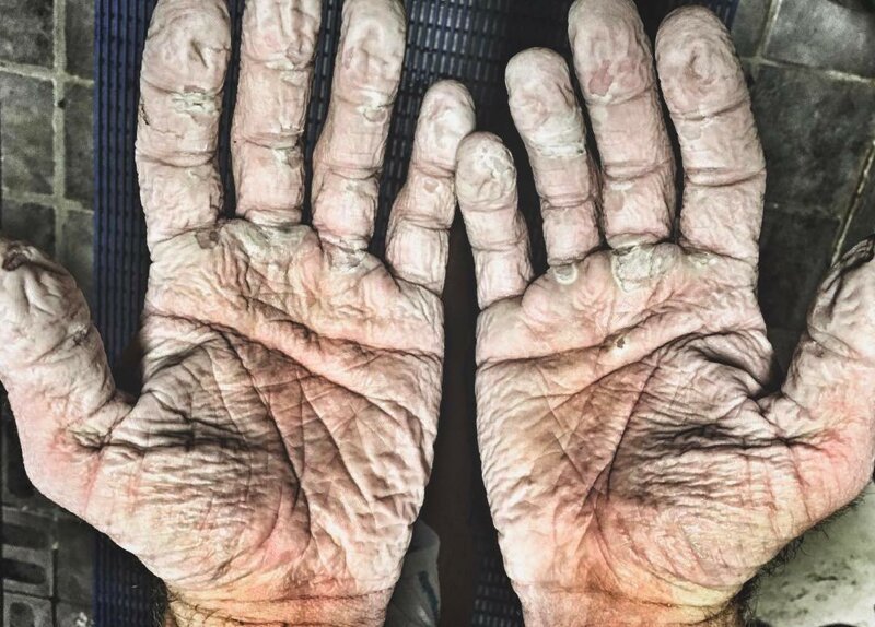 Ладони гребца после месяца практически непрерывной гребли в мокрых перчатках