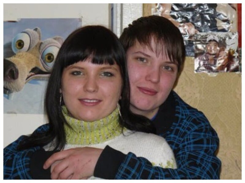 Первые удачно разделенные в СССР сиамские близнецы Аня и Таня Коркины: как они выглядят сейчас
