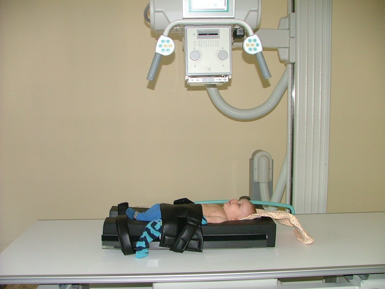 Делают рентген грудной клетки ребенку. Аппарат рентгеновский цифровой для исследования грудной клетки. Рентген грудной клетки новорожденного. Рентген аппарат для младенцев.