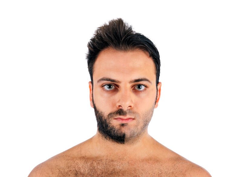 Почему у некоторых взрослых мужчин плохо растет борода?