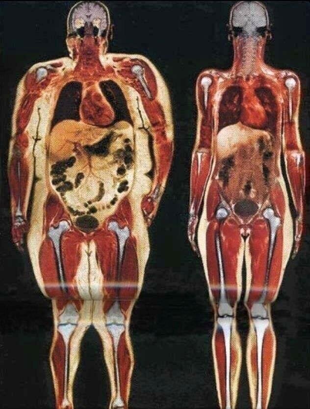 Слева — женщина 114 кг, справа — женщина 55 кг