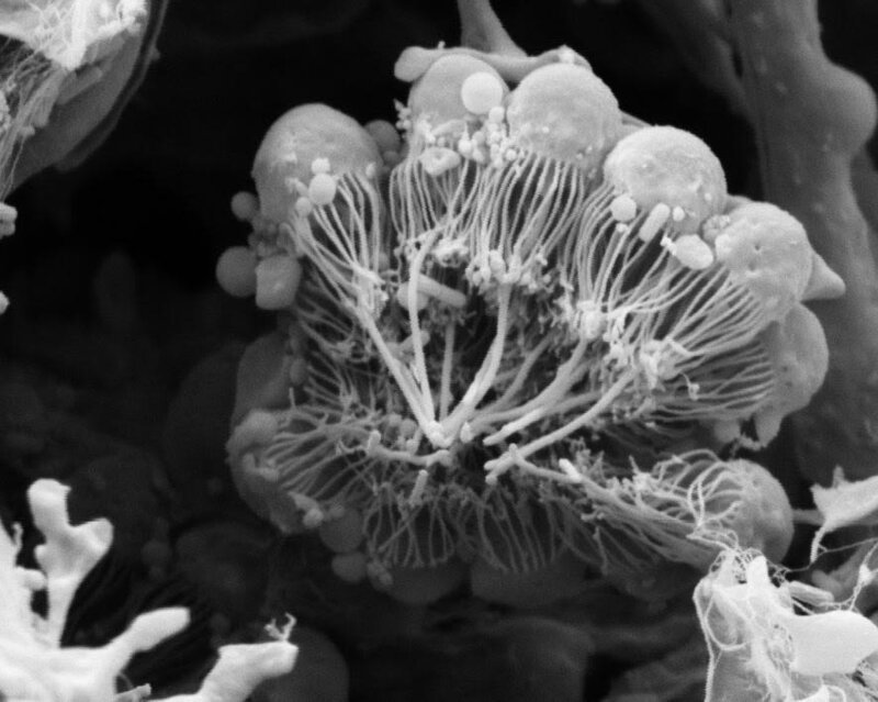 Микроскопическое изображение губки, в которой видны отдельные хоаноциты