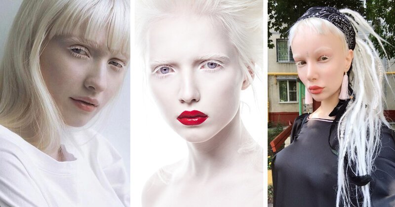 Нетипичная красота: яркие девушки-альбиносы