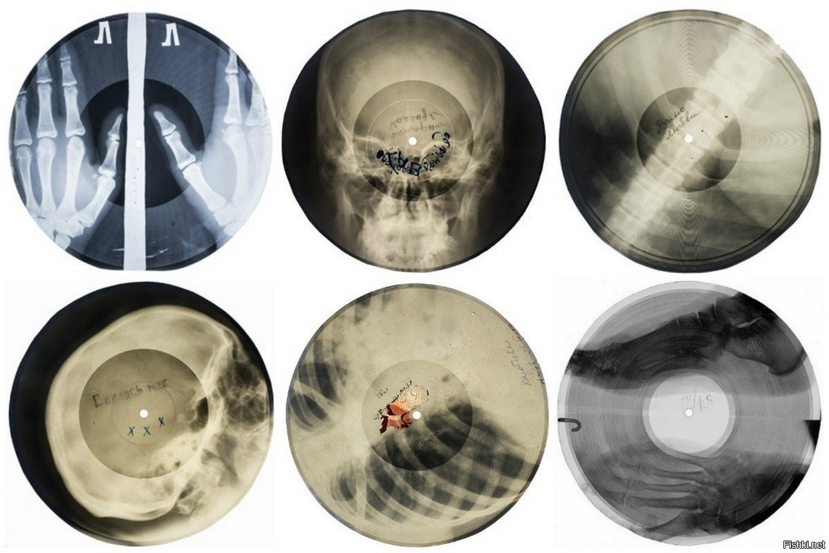 Пластинки на рентгеновских снимках СССР