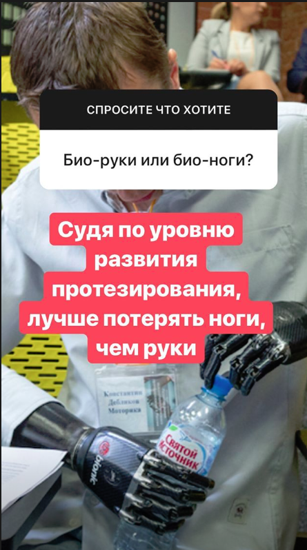 "Моете руки перед едой?": парень с бионическими протезами ответил на вопросы пользователей Сети
