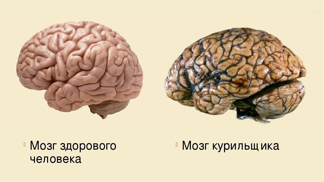 Центральный мозги. Мозг курильщика и здорового человека.