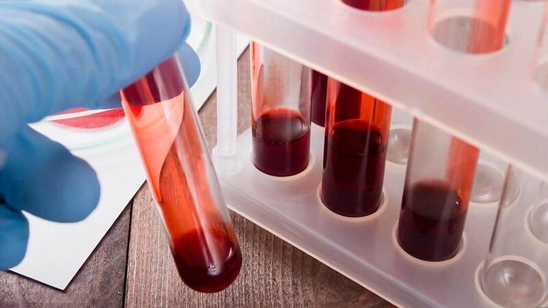 Правила и запреты: что можно и нельзя делать перед разными анализами крови?