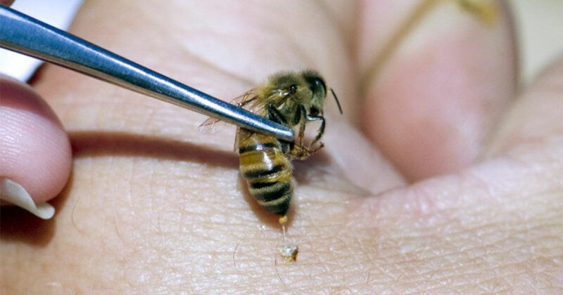 Укус пчелы как лечебное средство