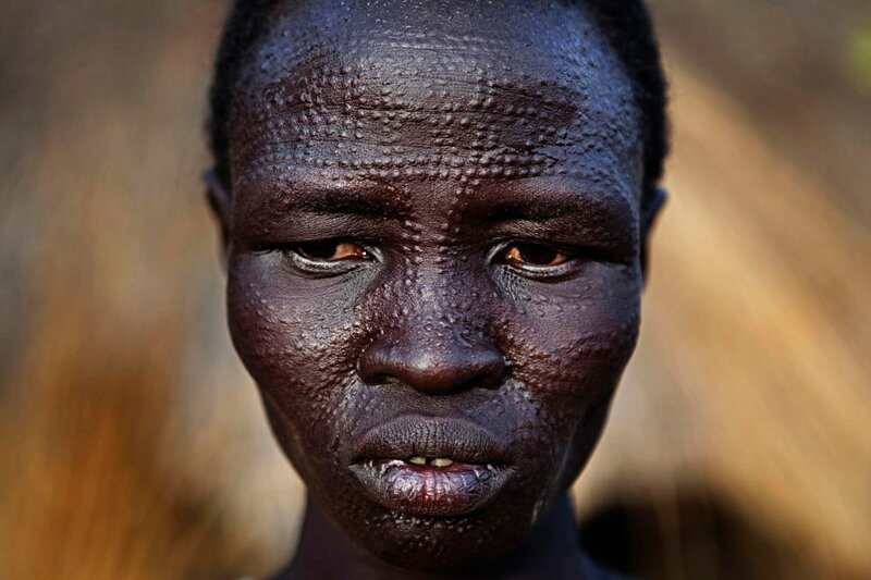 Несмотря на запрет подобных процедур, мужчины племени по-прежнему считают гладкую кожу «уродством».
