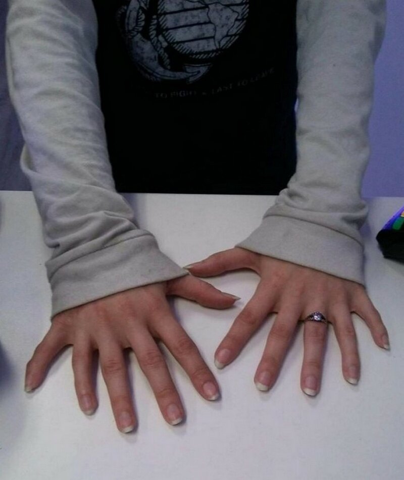 У покупательницы оказалось по шесть пальцев на каждой руке