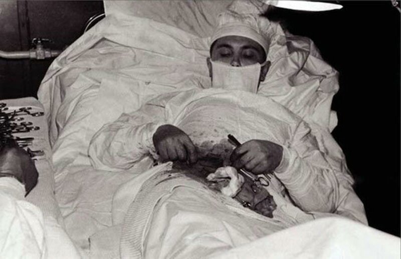 Леонид Рогозов, который в арктических условиях, будучи единственным врачом в экспедиции, сам себе удаляет аппендицит. Операция длилась 1 час 45 минут и прошла успешно