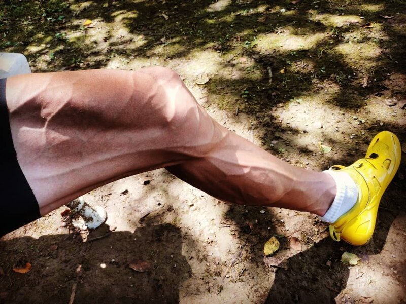 Велосипедист, борющийся с булимией, шокировал фотографией своих ног