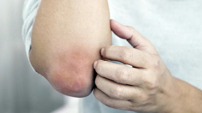 Грубая кожа вокруг ногтей – признаки проблемы, причины, лечение и профилактика
