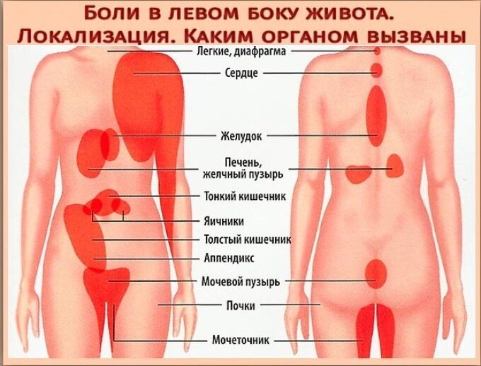 5 причин почему болит в левом боку. Сеть медицинских центров и МЦ «Здоровье» в Москве.