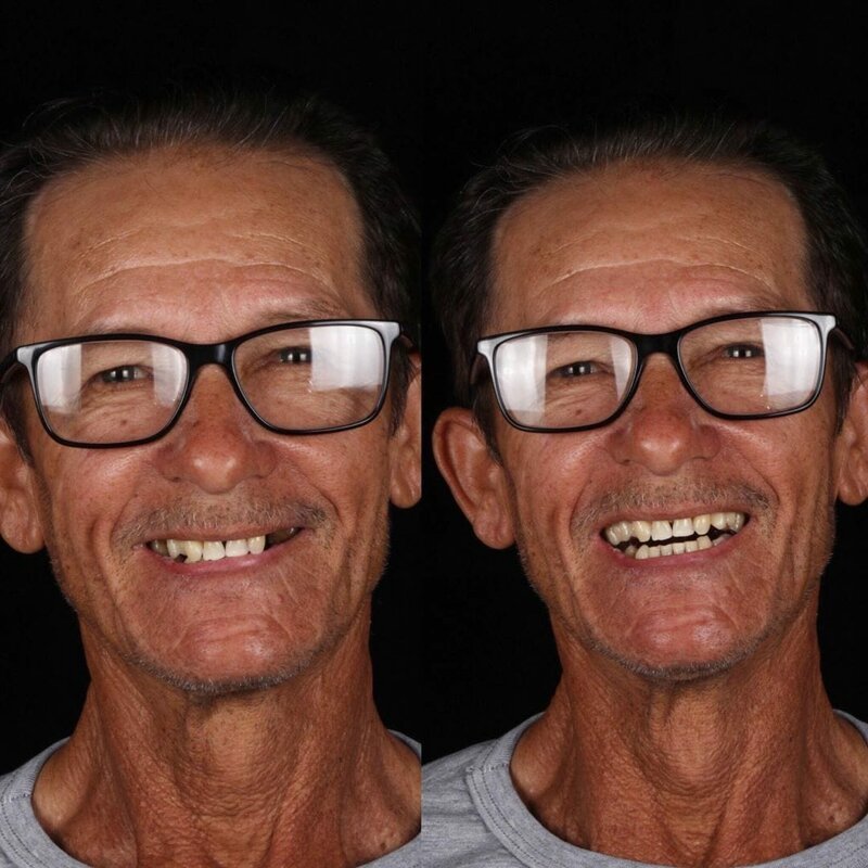 Стоматолог лечит зубы, и фотографии его работ показывают, как людей меняет улыбка