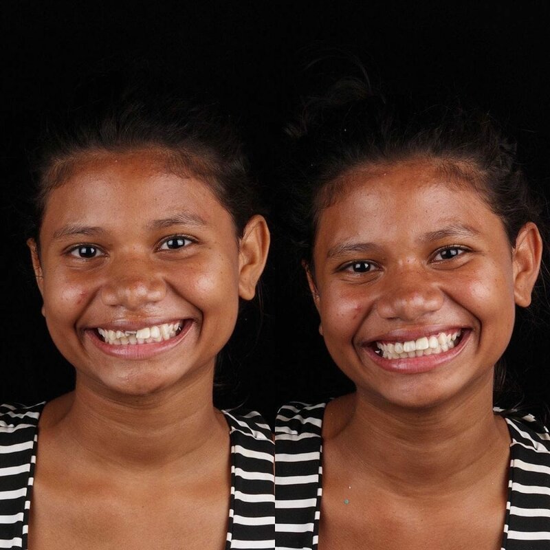 Стоматолог лечит зубы, и фотографии его работ показывают, как людей меняет улыбка