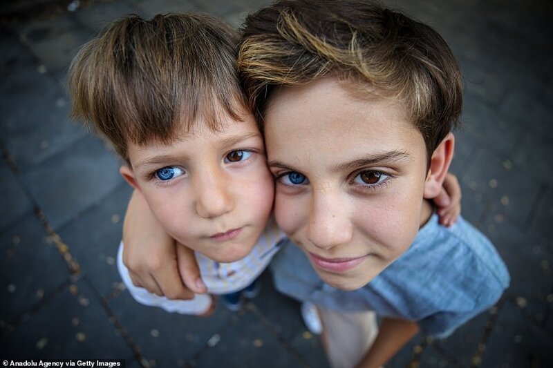 Разноцветные гены: братья из Турции с редкой гетерохромией завораживают с первого взгляда