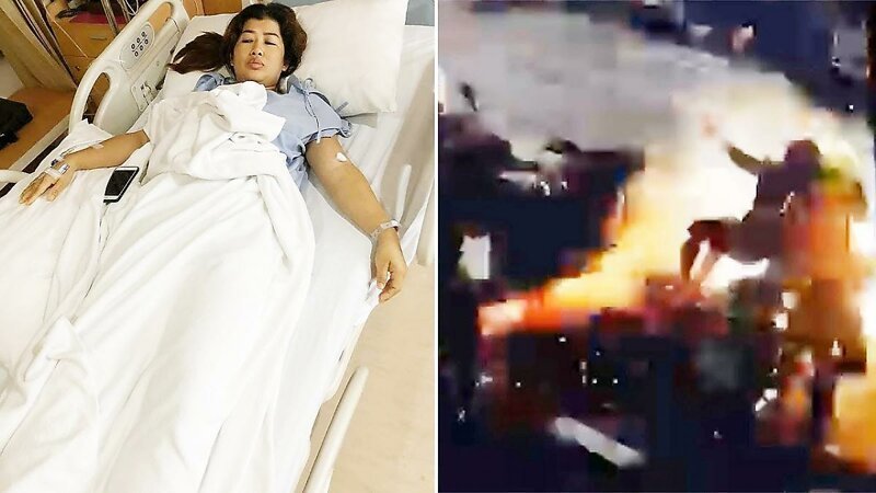 Женщина чудом осталась жива после удара током в 22000 вольт