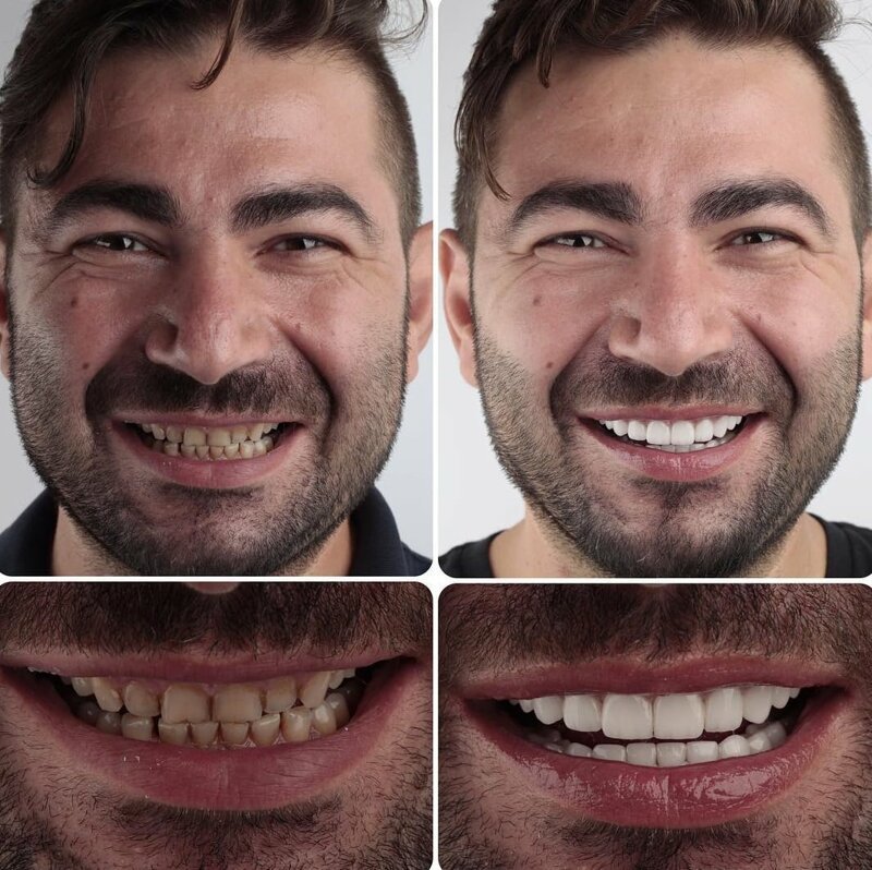 Как сделать улыбку на фото приложение