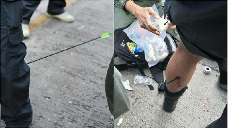 Беспорядки в Гонконге. Одного из полицейских ранило в ногу стрелой из лука