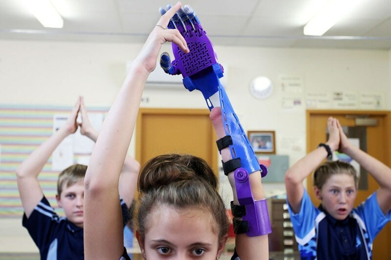 5. 12-летняя Хейли Райт тестирует 3D-протез, сделанный из переработанного пластика