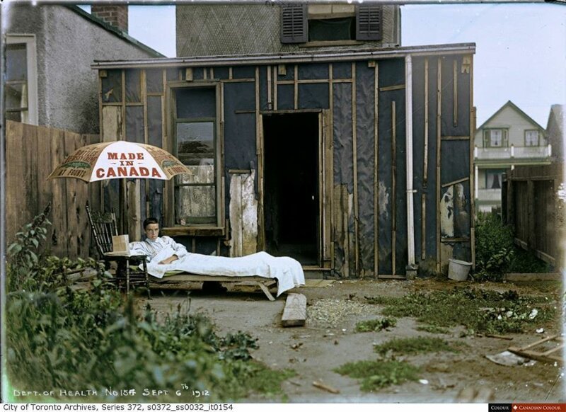 Мальчик больной туберкулезом принимает воздушные ванны на заднем дворе своего дома. 6 сентября 1912