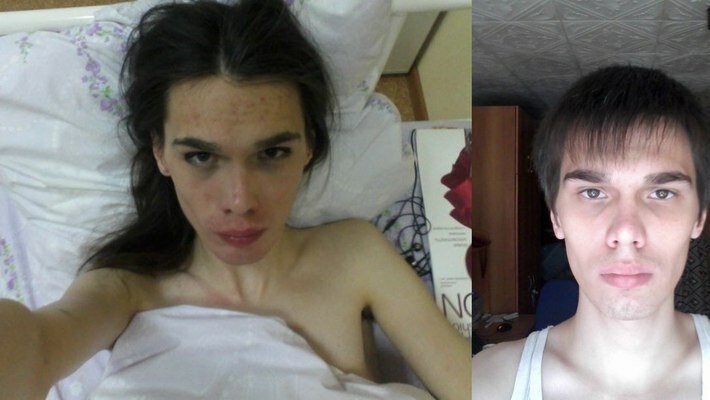 Фото смена пола до операции и после фото