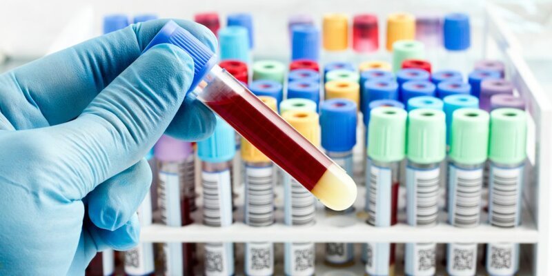 Ученые выяснили, с какой группой крови выше вероятность заразиться коронавирусом