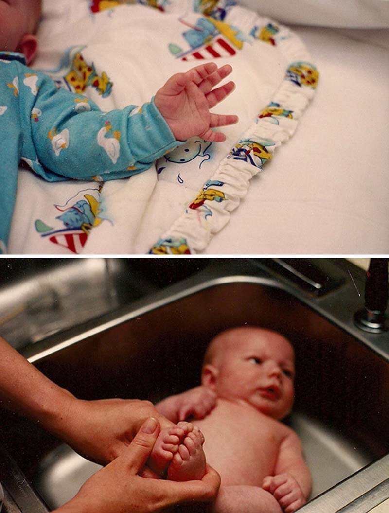 У малыша от рождения - по лишнему пальчику на каждой руке и ноге!