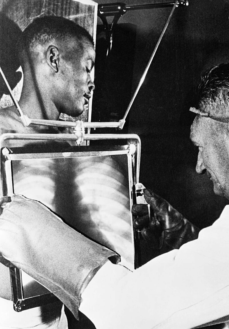 Рентгенолог проверяет желудок шахтера на наличие проглоченных алмазов, Кимберли, ЮАР, 1954 год.