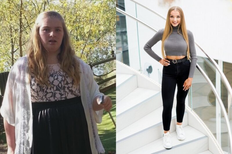 Девушка нашла способ похудеть без операций