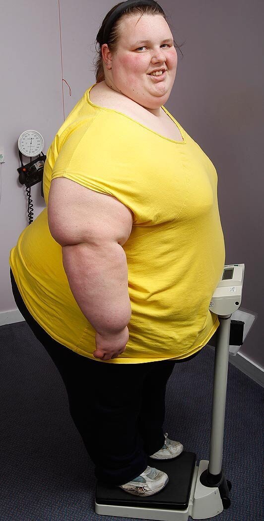 Девушку зовут Джорджия Дэвис - и она рекордсменка книги Гиннесса как самый толстый подросток Британии - вес ее в 19 был более 400 кг.