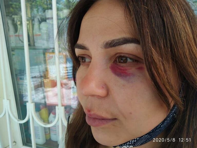 4. Тренер по ММА избил продавщицу в Крыму за требование надеть маску