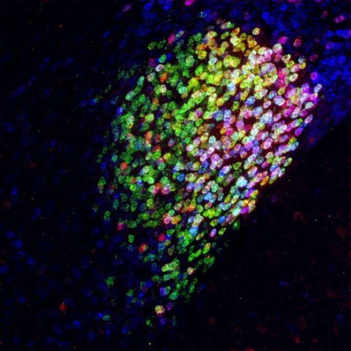 Нейроны в центральной миндалине мозга мыши