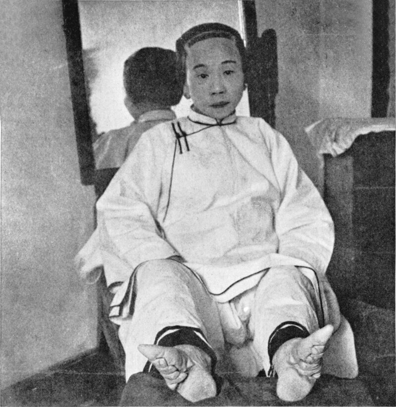 Китайская знать 1911 год, бинтование и уродство ног было привилегий китайских богачей, при таких ногах женщины не могли ходить без посторонней помощи и это указывалось на её влиятельное положение в обществе.