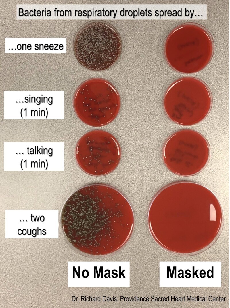 Бактерии, распространяемые дыхательными каплями. В маске/без маски