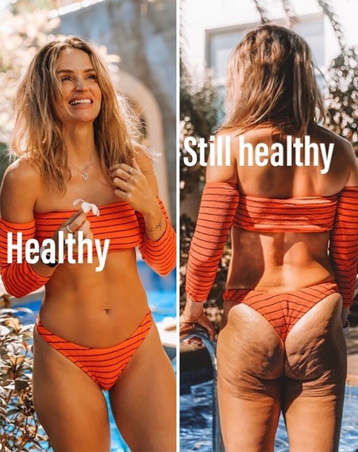 Здоровая / тоже здоровая