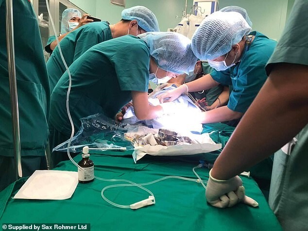 Команда из 100 врачей разделила сиамских близнецов