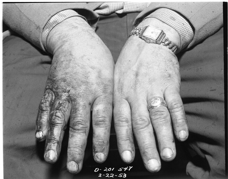 33-летний убийца Кларенс Викери в наручниках, 1953