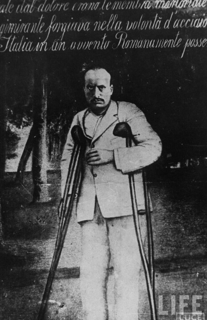 Бенито Муссолини в пижаме, опирается на костыли после получения ранения во время его службы капралом 14-го Берсальерского полка во время первой мировой войне. 1917