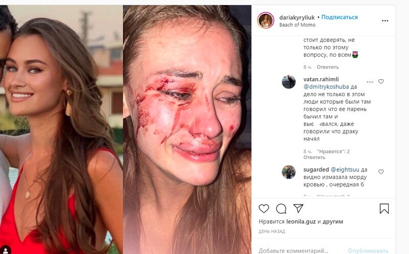 Украинскую модель, отдыхавшую в Турции, избили охранники пляжа