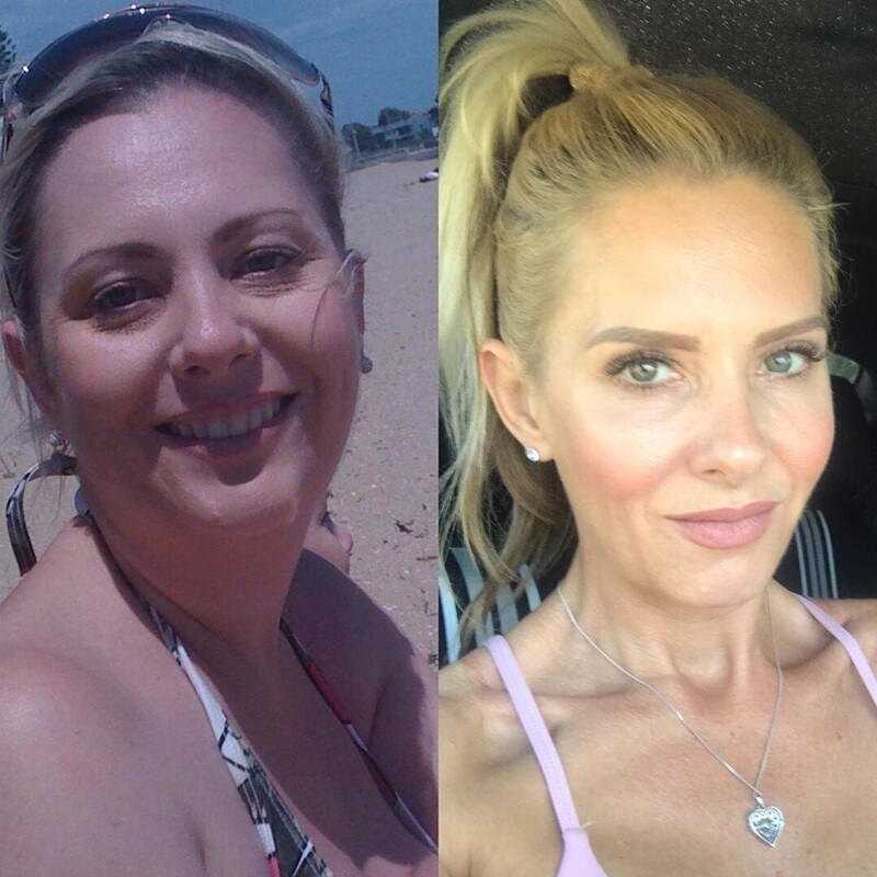 Отказ от сахара до и после фото