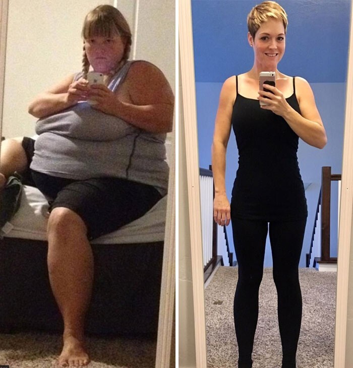 35. "Было 105 кг, стало 55 кг. Сделала рукавную гастропластику три года назад и полностью поменяла образ жизни"