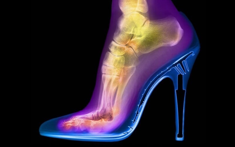 4. Раскрашенный рентген женской ступни в туфлях на каблуке