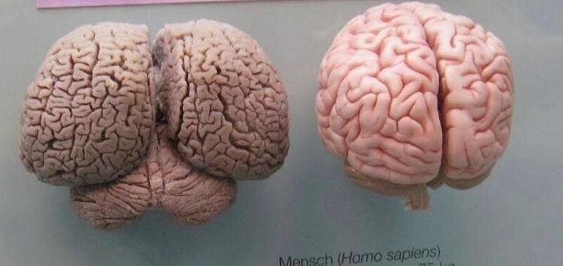Мозг дельфина и человека