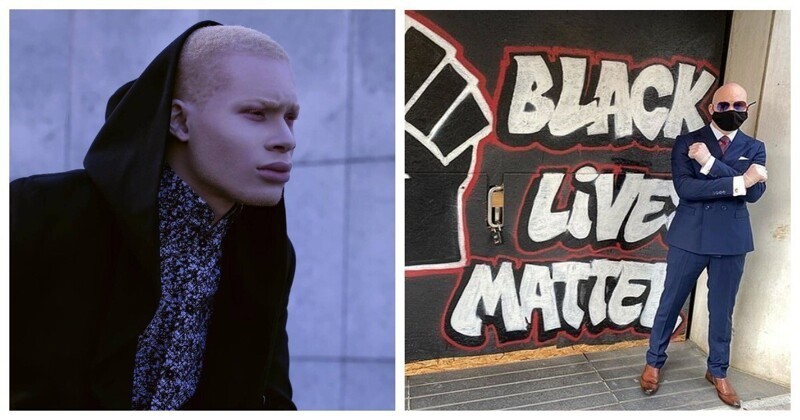 Негр-альбинос присвоил деньги, собранные для движения Black Lives Matter