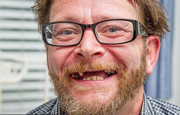 Британец не смог записаться к дантисту и, напившись, сам удалил два зуба плоскогубцами
