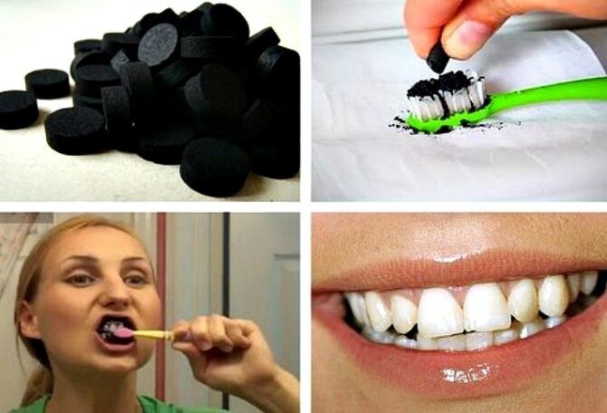 Как отбелить зубы дома?