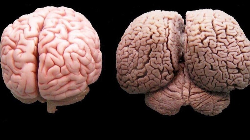 Человеческий мозг и мозг дельфина