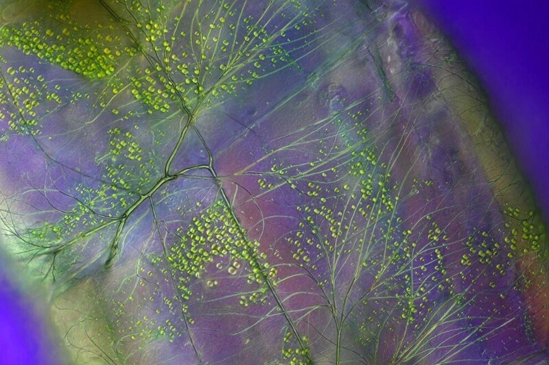 Тело личинки Chaoboridae с нервной системой и каплями жира. (Фото Anne Gleich, Kaiserslautern, Rheinlandpfalz, Germany):